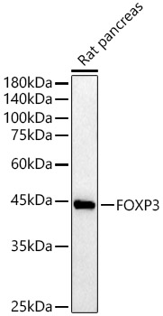 FOXP3 Rabbit pAb