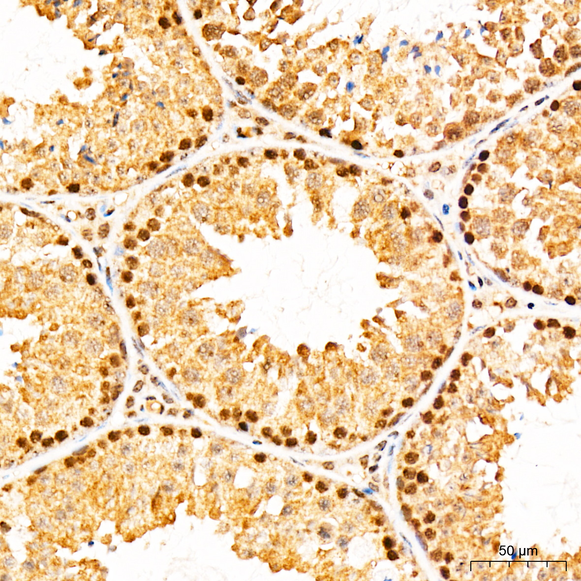 AMPKα1 Rabbit pAb