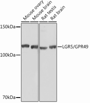 LGR5/GPR49 Rabbit mAb