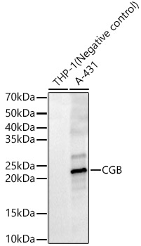 CGB Rabbit pAb