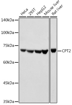 CPT2 Rabbit pAb