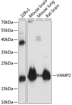 VAMP2 Rabbit pAb