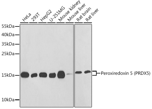 Peroxiredoxin 5 (PRDX5) Rabbit pAb