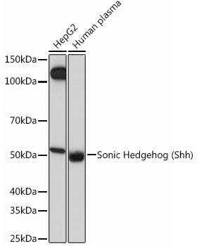 Sonic Hedgehog (Shh) Rabbit mAb