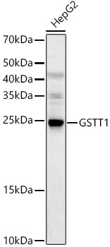 GSTT1 Rabbit pAb