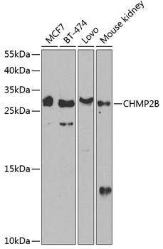 CHMP2B Rabbit pAb