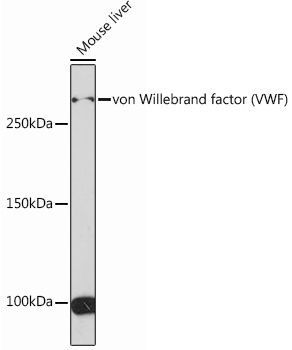 von Willebrand factor (VWF) Rabbit mAb