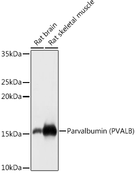 Parvalbumin/PVALB Rabbit pAb