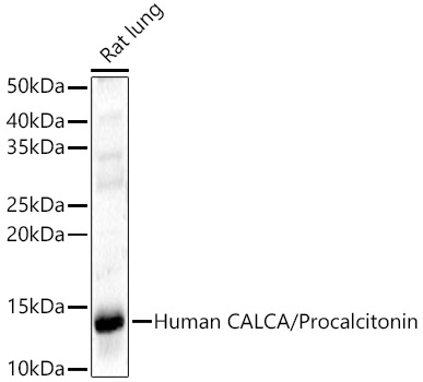 CALCA Rabbit pAb