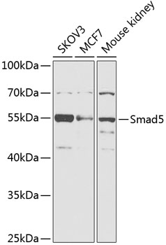 Smad5 Rabbit pAb