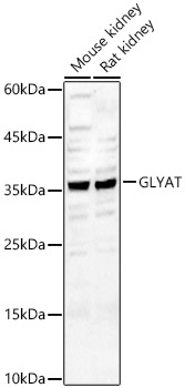 GLYAT Rabbit pAb