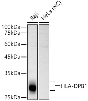 HLA-DPB1 Rabbit pAb