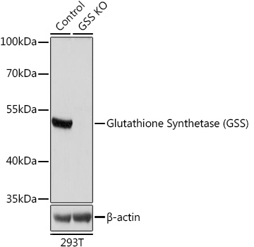Glutathione Synthetase (GSS) Rabbit mAb