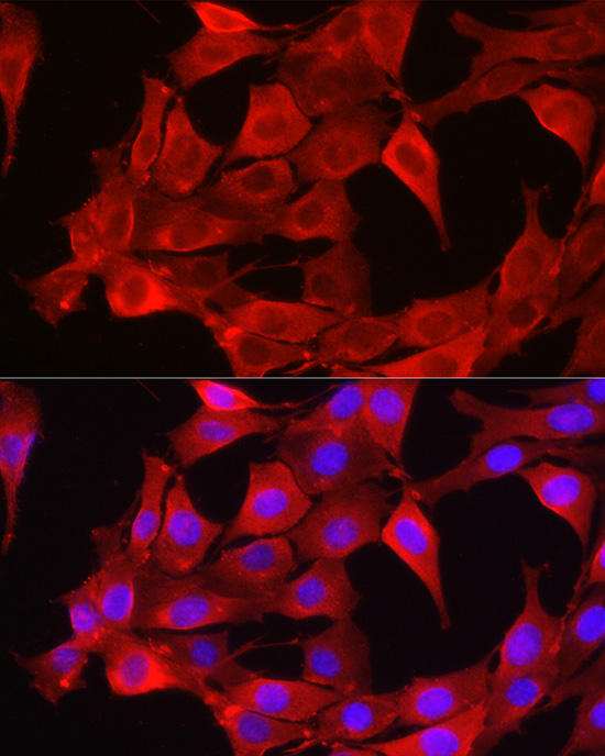 glutathione nih precursor GlyNAC reverses premature aging in people with HIV What is Glutathione?  GoldBio