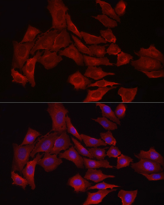 glutathione synthetase antibody Mouse Monoclonal Anti Glutathione Synthetase Polyclonal Antibody
