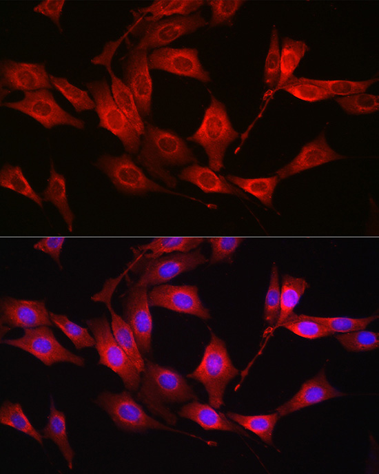 glutathione synthetase antibody Anti-Glutathione [EPR6563] Validated Species KO Validated] Glutathione Synthetase (GSS)