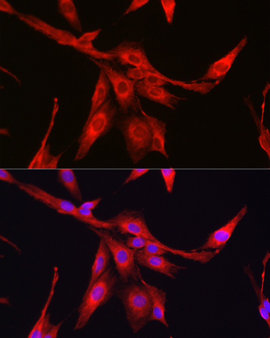 glutathione fluorescent antibody KO Validated] Synthetase (GSS) Rabbit pAb Glutathione Fluorescent Detection Kit |