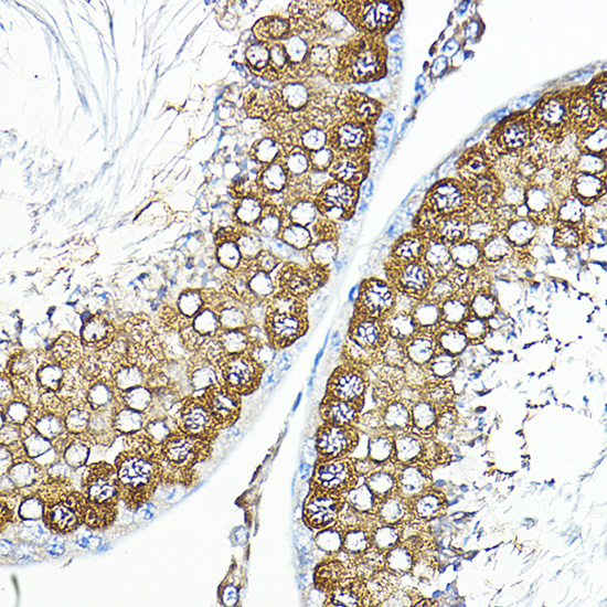 Calmodulin 1/2/3 Rabbit pAb