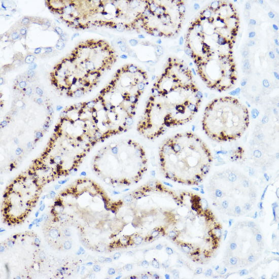 LDL Receptor (LDLR) Rabbit pAb