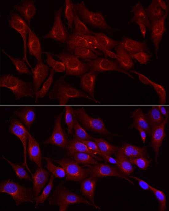 LDL Receptor (LDLR) Rabbit pAb