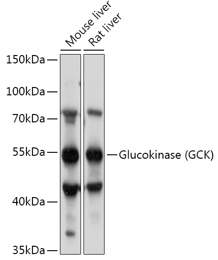 Glucokinase (GCK) Rabbit pAb