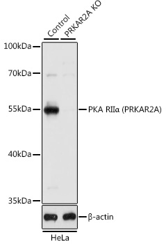 [KO Validated] PKA RIIα (PRKAR2A) Rabbit pAb