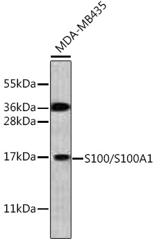 S100/S100A1 Rabbit pAb