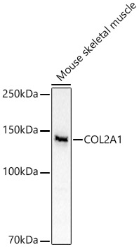 COL2A1 Rabbit pAb