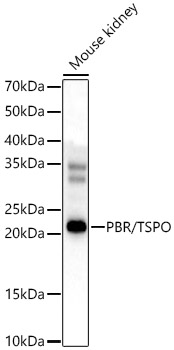 PBR/TSPO Rabbit pAb