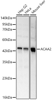 ACAA2 Rabbit pAb