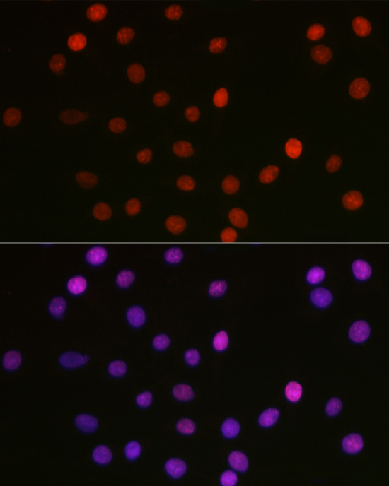 Acetyl-HMGB1-K29 Rabbit pAb