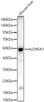 ALDH5A1 Rabbit pAb