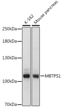 MBTPS1 Rabbit pAb