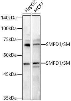 SMPD1 / ASM Rabbit pAb