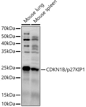 CDKN1B/p27KIP1 Rabbit pAb