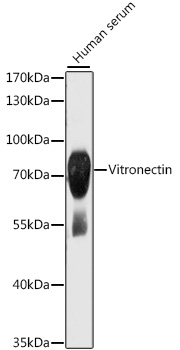 Vitronectin Rabbit pAb