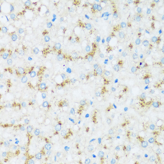 APOD Rabbit pAb-Polyclonal Antibodies - ABclonal/拜爾國際(BioAb)