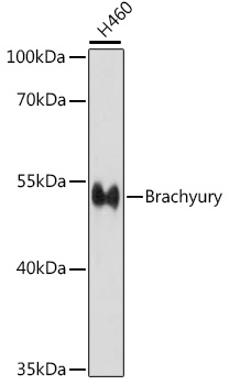 Brachyury Rabbit pAb