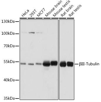 [KO Validated] βIII-Tubulin Rabbit pAb