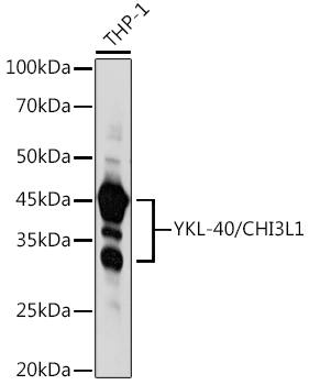 akominmin様3点おまとめ ユリエニタニ  INDIVI ICB ZMYND11 links histone H3.3K36me3 to transcription elongation