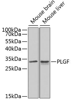 PLGF Rabbit pAb