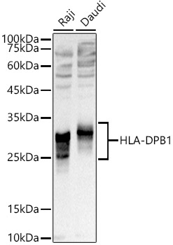 HLA-DPB1 Rabbit pAb