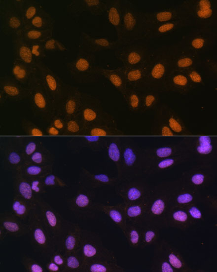 MonoMethyl-Histone H4-R3 Rabbit pAb