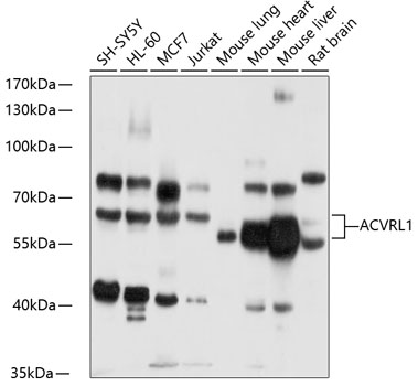 ACVRL1 Rabbit pAb