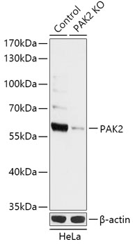 [KO Validated] PAK2 Rabbit pAb