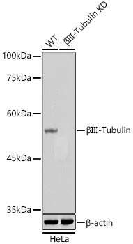 [KD Validated] βIII-Tubulin Mouse mAb