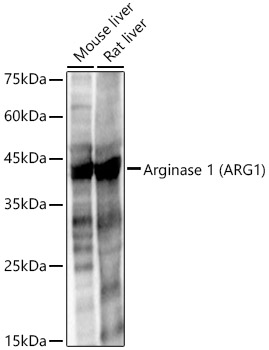 Arginase 1 (ARG1) Rabbit pAb