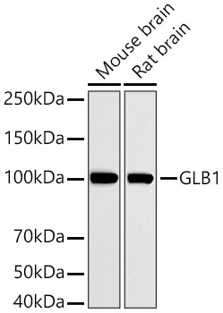 GLB1 Rabbit pAb