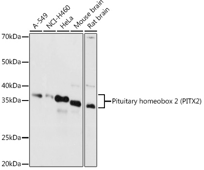 Pituitary homeobox 2 (PITX2) Rabbit pAb