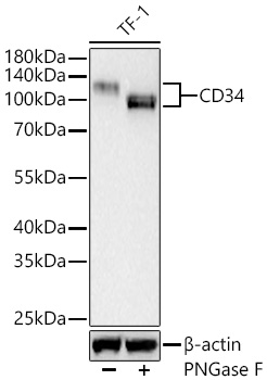 CD34マイナス ミルク CD34 Rabbit mAb